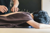 Best Acupuncturists in Chicago in 2023