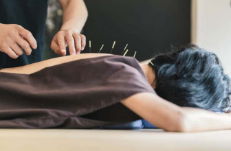 Best Acupuncturists in Chicago in 2021