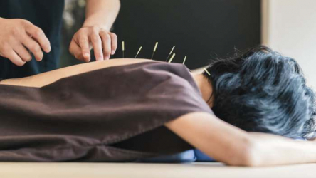 Best Acupuncturists in Chicago in 2021