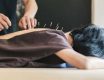 Best Acupuncturists in Chicago in 2021